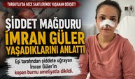 Turgutlu'da Kan Donduran Şiddet: Eşinin Burnunu Kopardı!