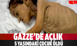 Gazze’de Açlık 5 Yaşındaki Çocuk Öldü