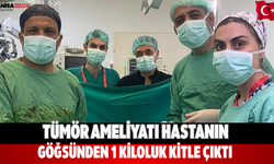Tümör ameliyatı Hastanın göğsünden 1 kiloluk kitle çıktı