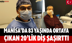 Manisa’da 83 yaşında ortaya çıkan 20’lik diş şaşırttı