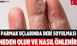 Parmak Uçlarında Deri Soyulması Neden Olur ve Nasıl Önlenir.