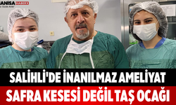 Salihli'de İnanılmaz Ameliyat Safra Kesesi Değil Taş Ocağı