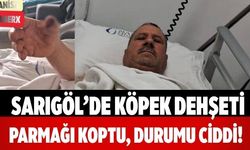 Sarıgöl’de Köpek Dehşeti Parmağı Koptu, Durumu Ciddi!