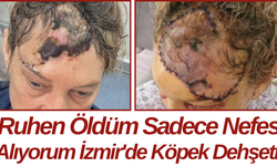 Ruhen Öldüm Sadece Nefes Alıyorum İzmir'de Köpek Dehşeti