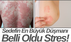 Sedefin En Büyük Düşmanı Belli Oldu Stres!