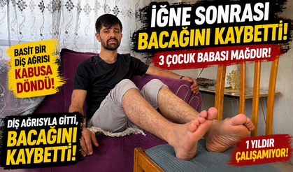 Diş Ağrısıyla Gitti, Bacağını Kaybetti! 1 Yıldır Çalışamıyor