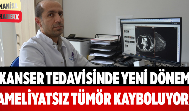 Kanser Tedavisinde Yeni Dönem Ameliyatsız Tümör Kayboluyor!
