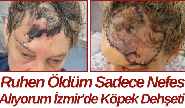 Ruhen Öldüm Sadece Nefes Alıyorum İzmir'de Köpek Dehşeti