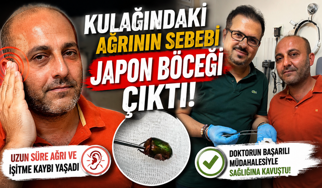 Kulağındaki Ağrının Sebebi Japon Böceği Çıktı