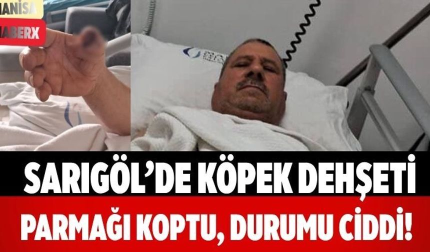 Sarıgöl’de Köpek Dehşeti Parmağı Koptu, Durumu Ciddi!